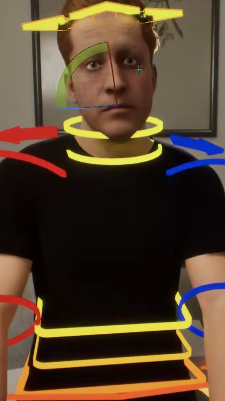 Facial motion-capture rig applied to the virtual patient in Unreal Engine 5